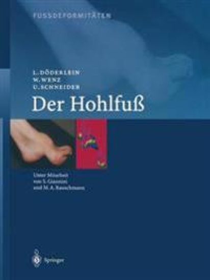 Fussdeformitäten