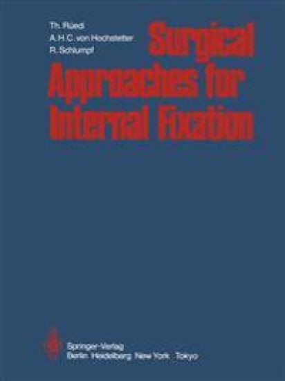 Surgical Approaches for Internal Fixation