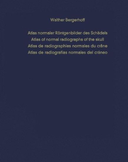 Atlas Normaler Röntgenbilder Des Schädels / Atlas of Normal Radiographs of the Skull / Atlas de Radiographies Normales Du Crâne / Atlas de Radiografia