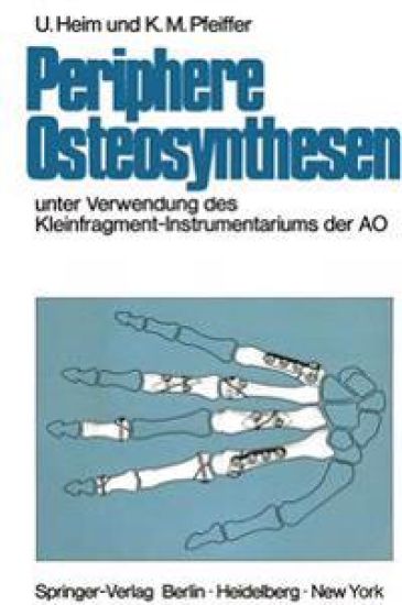 Periphere Osteosynthesen