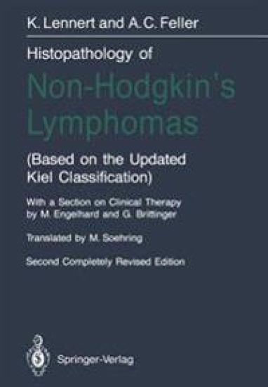 Histopathology of Non-Hodgkin’s Lymphomas
