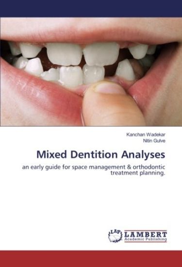 Mixed Dentition Analyses