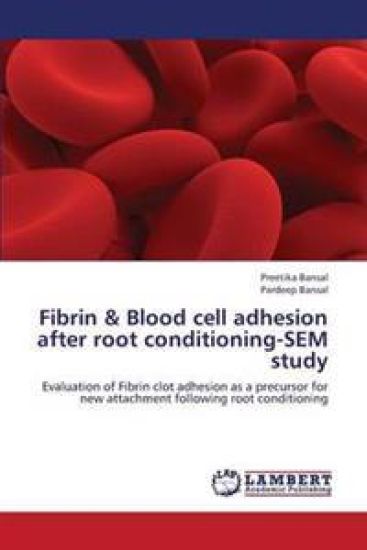Fibrin & Blood cell adhesion after root conditioning-SEM study