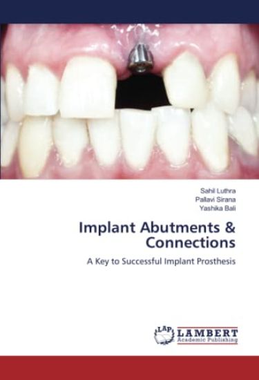 Implant Abutments & Connections