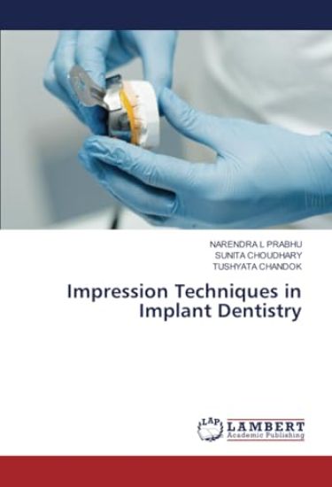 Impression Techniques in Implant Dentistry