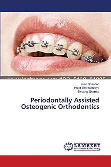 Periodontally Assisted Osteogenic Orthodontics