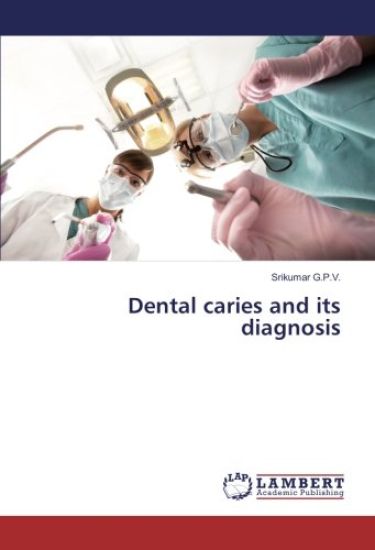 Dental caries and its diagnosis