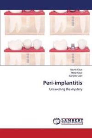 Peri-implantitis