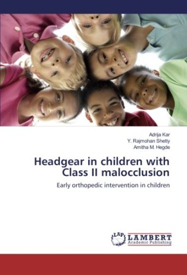 Headgear in children with Class II malocclusion