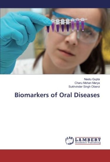 Biomarkers of Oral Diseases