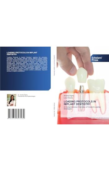 Loading Protocols in Implant Dentistry