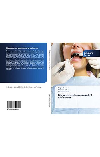 Diagnosis and assessment of oral cancer
