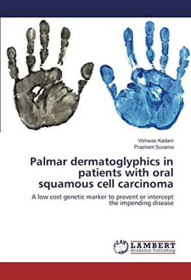 Palmar dermatoglyphics in patients with oral squamous cell carcinoma