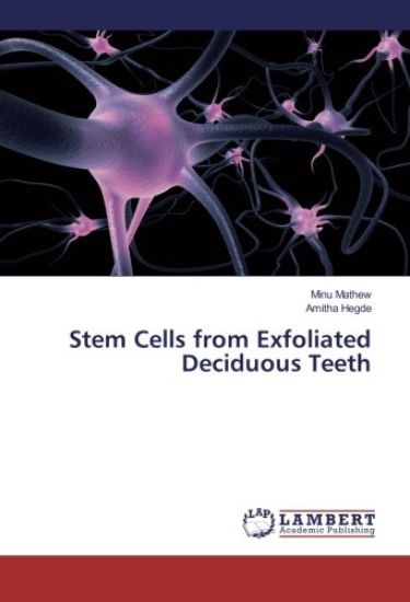 Stem Cells from Exfoliated Deciduous Teeth
