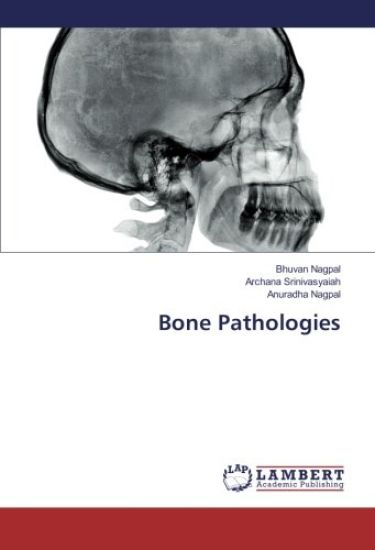 Bone Pathologies