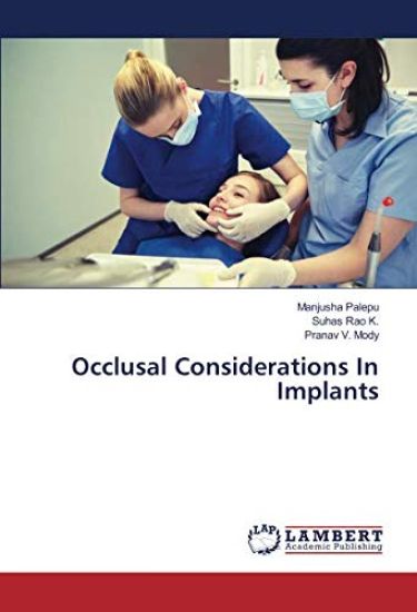 Occlusal Considerations In Implants