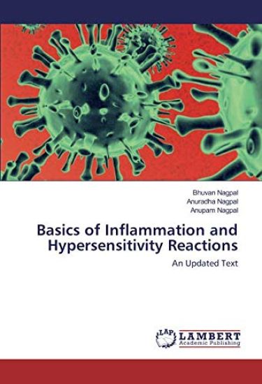 Basics of Inflammation and Hypersensitivity Reactions