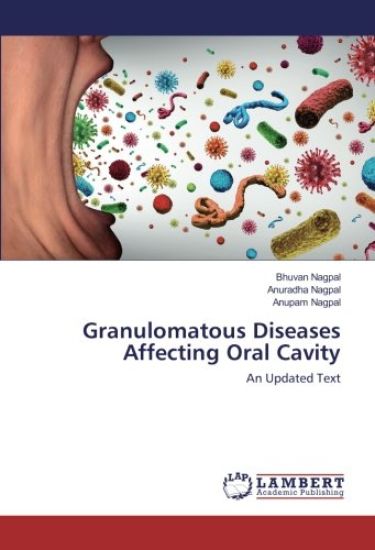 Granulomatous Diseases Affecting Oral Cavity