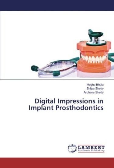 Digital Impressions in Implant Prosthodontics