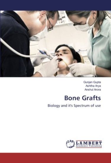Bone Grafts