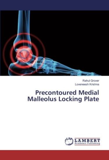 Precontoured Medial Malleolus Locking Plate