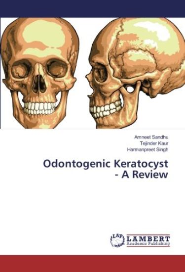 Odontogenic Keratocyst - A Review