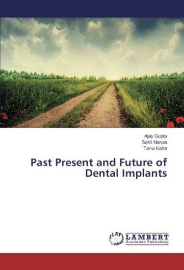 Past Present and Future of Dental Implants