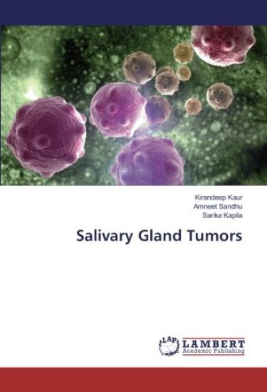 Salivary Gland Tumors