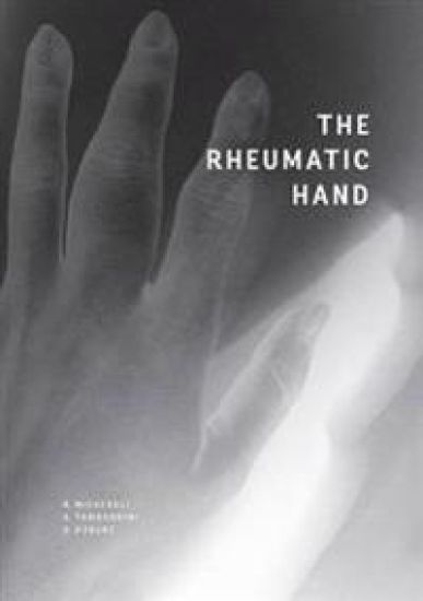 The Rheumatic Hand