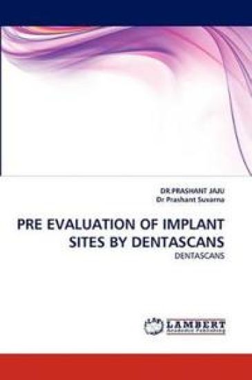 Pre Evaluation of Implant Sites by Dentascans