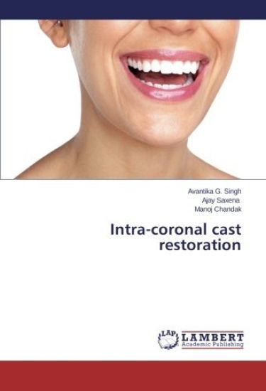 Intra-coronal cast restoration