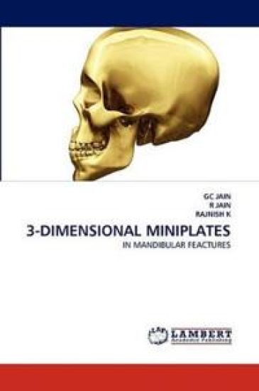 3-Dimensional Miniplates