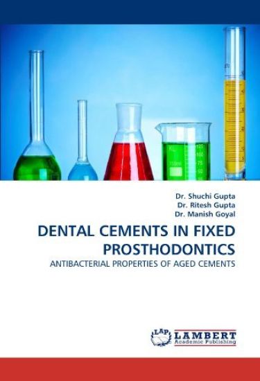 Dental Cements in Fixed Prosthodontics