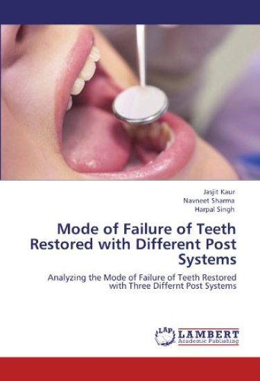 Mode of Failure of Teeth Restored with Different Post Systems