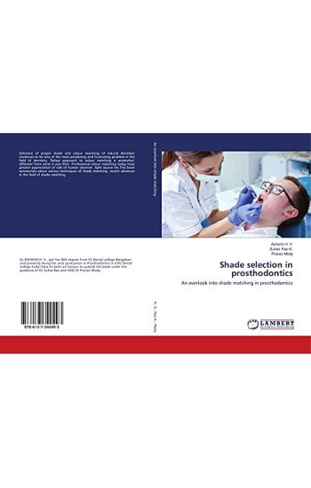Shade selection in prosthodontics