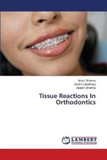Tissue Reactions In Orthodontics – Ankur Sharma, kirjan kansikuva