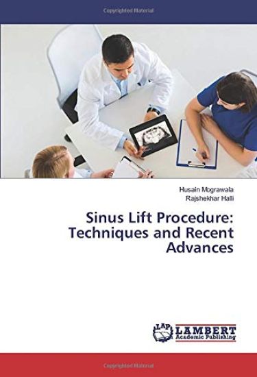 Sinus Lift Procedure: Techniques and Recent Advances