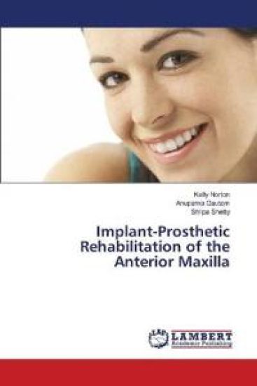 Implant-Prosthetic Rehabilitation of the Anterior Maxilla