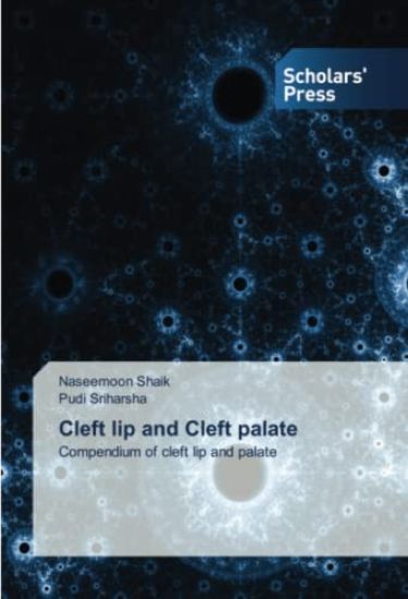 Cleft lip and Cleft palate