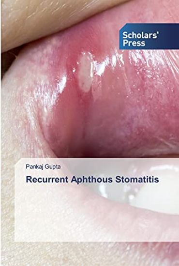 Recurrent Aphthous Stomatitis – Pankaj Gupta, kirjan kansikuva