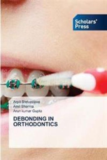 Debonding in Orthodontics – Arpit Shrivastava, kirjan kansikuva