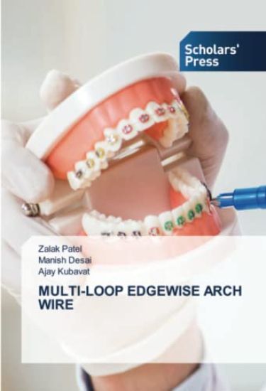 Multi-Loop Edgewise Arch Wire