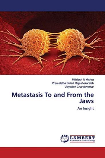 Metastasis To and From the Jaws