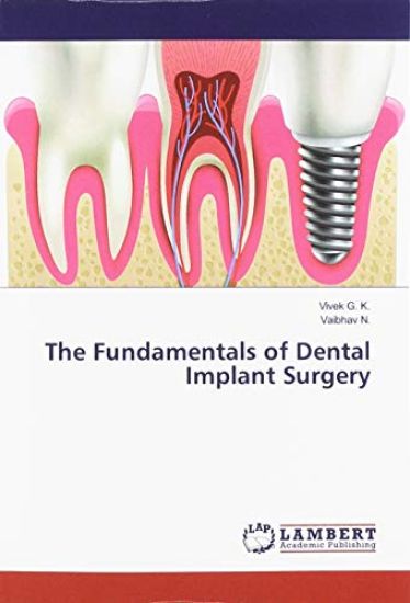 The Fundamentals of Dental Implant Surgery