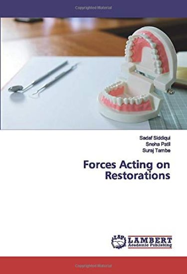 Forces Acting on Restorations