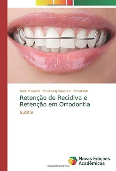Retenção de Recidiva e Retenção em Ortodontia
