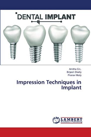 Impression Techniques in Implant