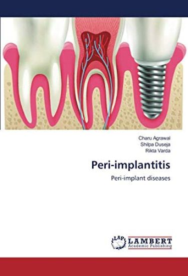 Peri-implantitis