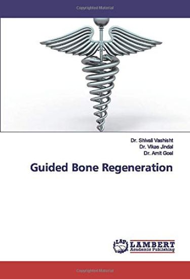 Guided Bone Regeneration