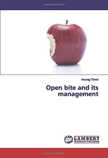 Open bite and its management